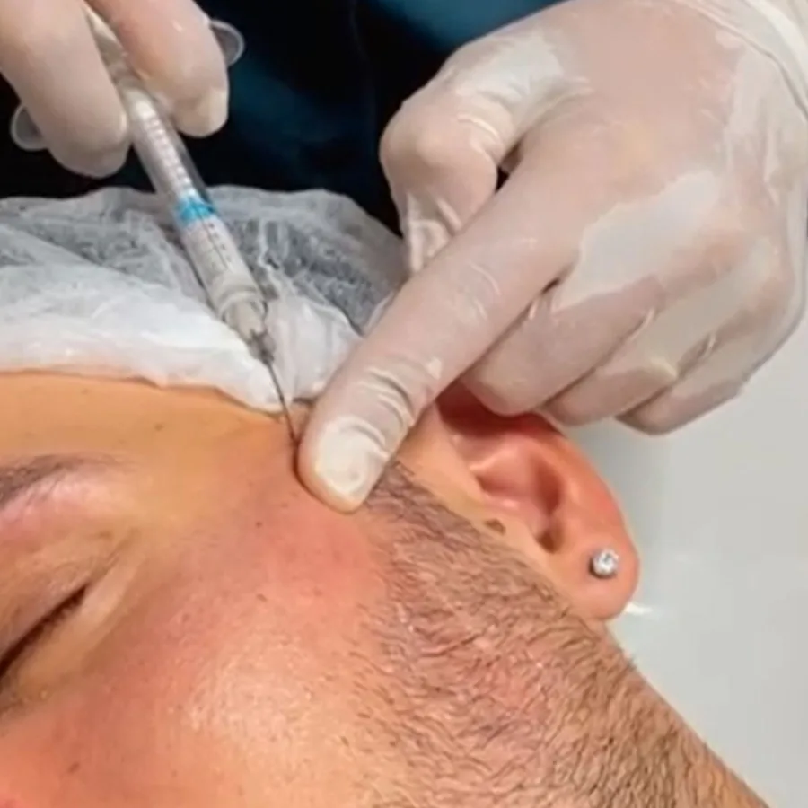 Tratamento de Rugas em Guarulhos - Estética Silvana Araújo